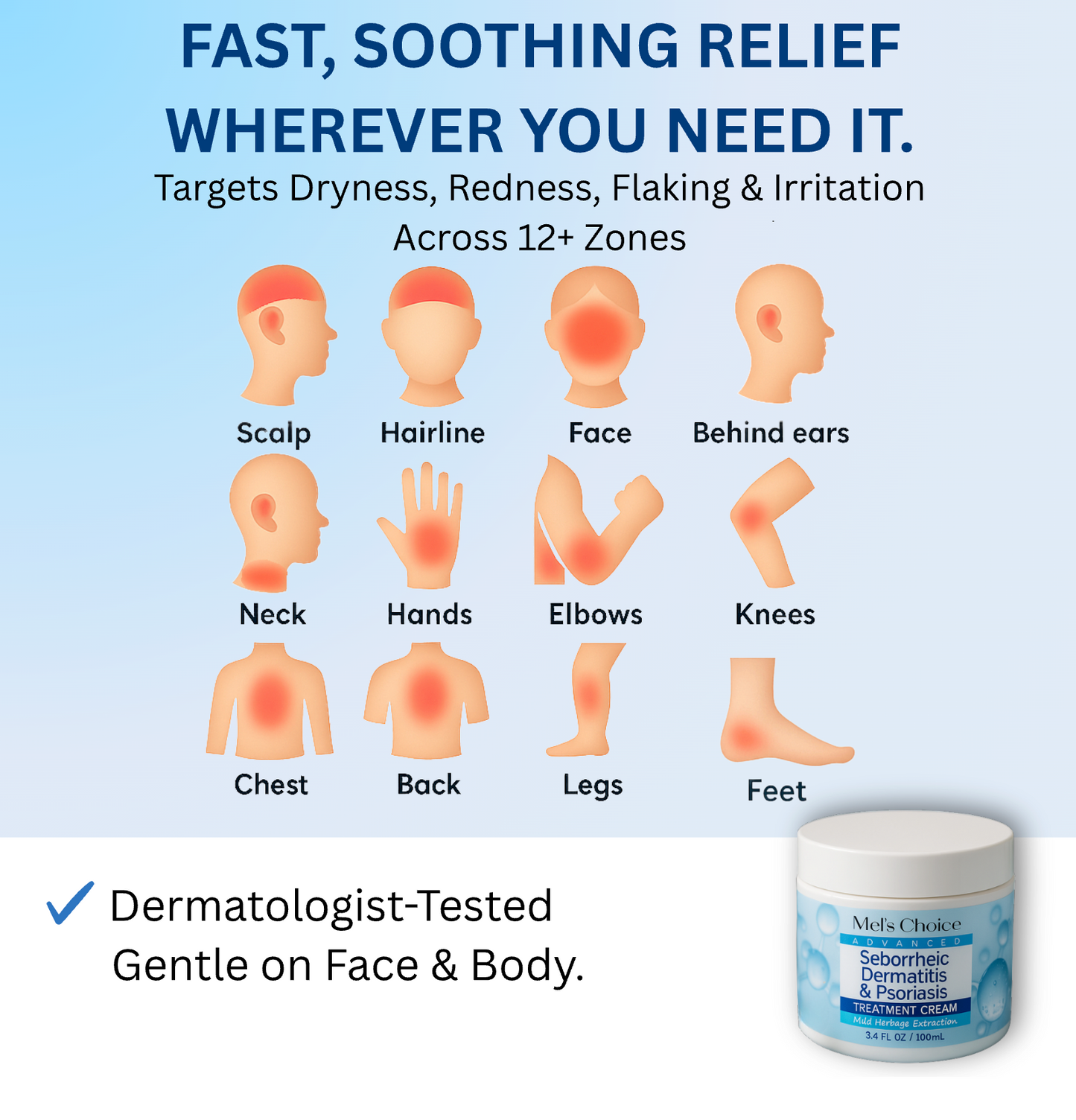 Seborrheic Dermatitis & Psoriasis Cream